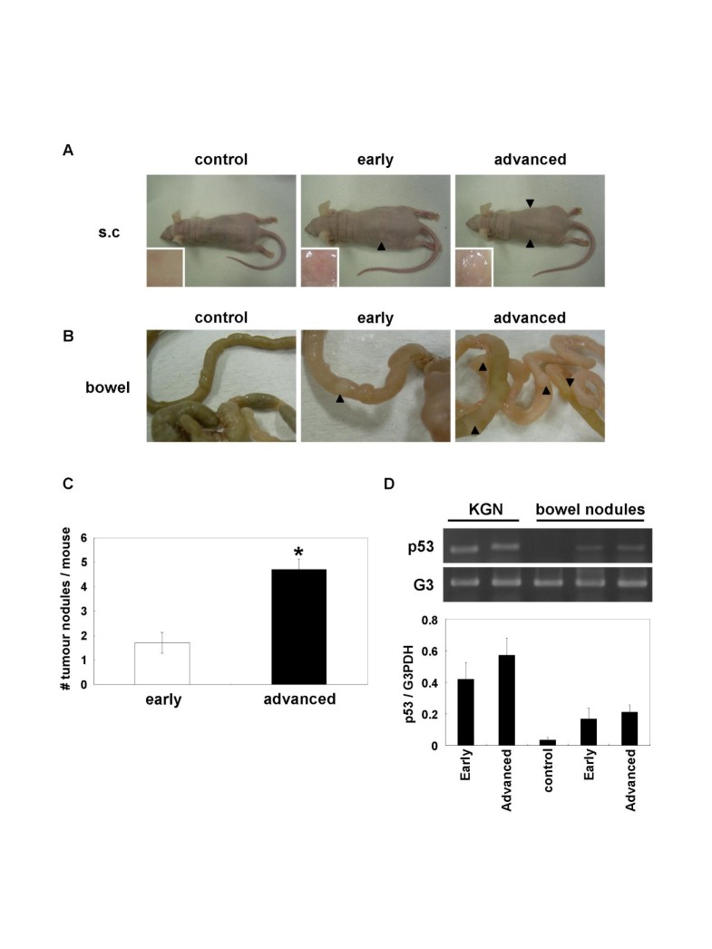 Growth and metastases of KGN cells in nude mice. KGN cells 