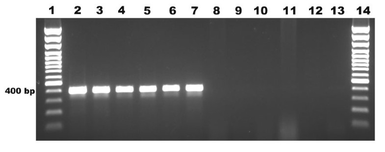 Specific detection of fungal pathogens by 18S rRNA gene PCR in