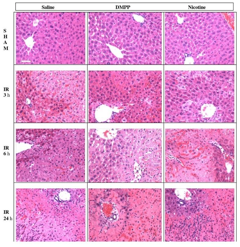 Protection of early phase hepatic ischemia-reperfusion injury by ...