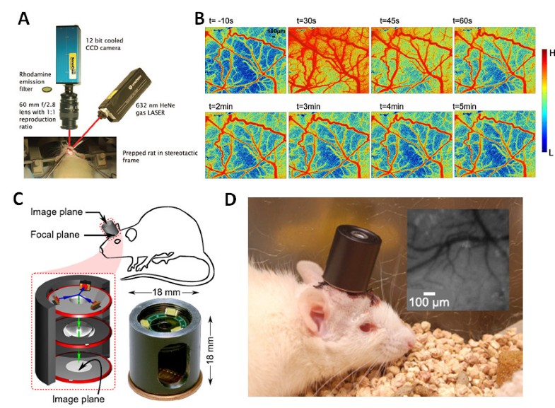 Neurovascular coupling in vivo optical techniques for functional brain