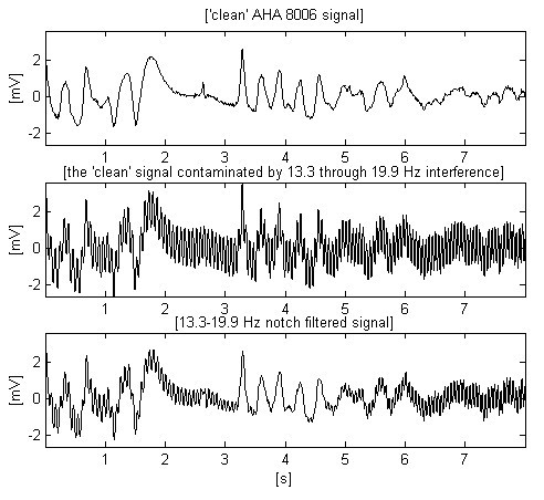 Suppression of AC railway power-line interference in ECG signals ...
