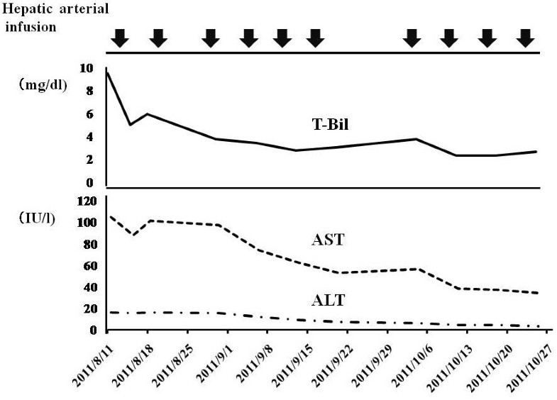 blood t-bil test infusion after Partial arterial transcatheter response