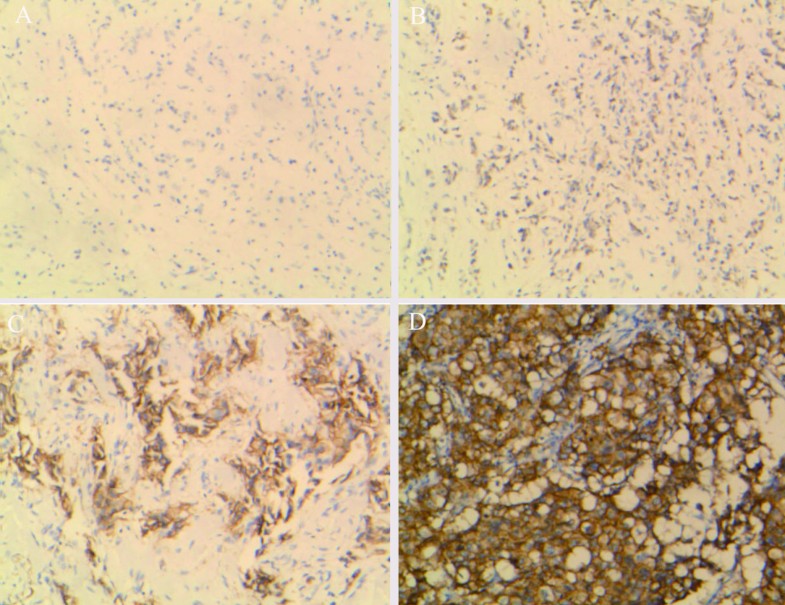 Comparison of immunohistochemistry (IHC) and fluorescence in situ