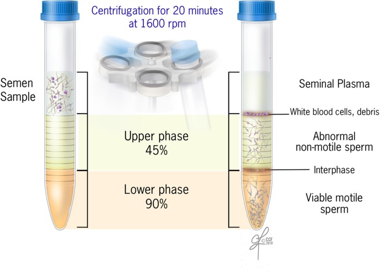 statistical calculations of mixed dna samples statistical calculations of mixed dna samples