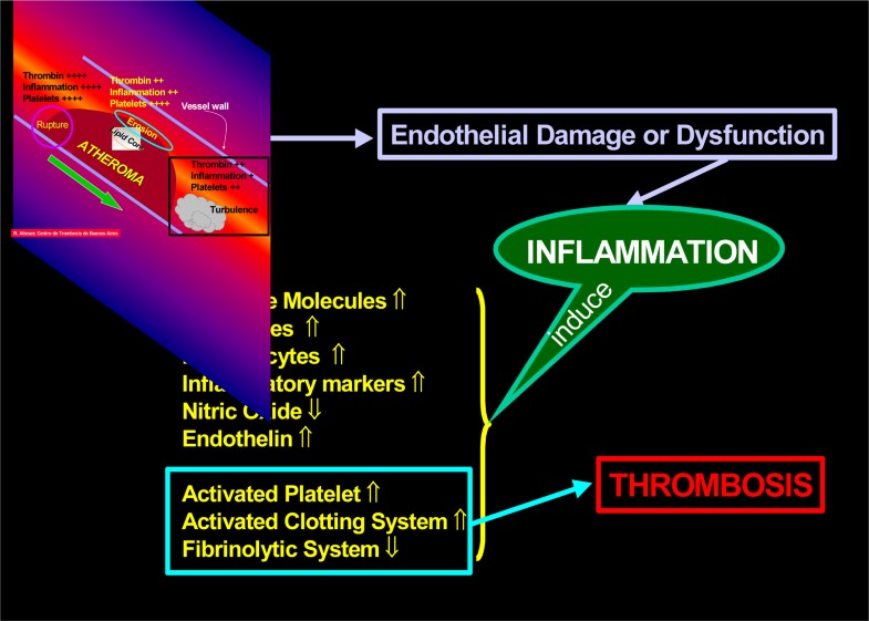 Acute coronary disease AtheroInflammation Therapeutic approach