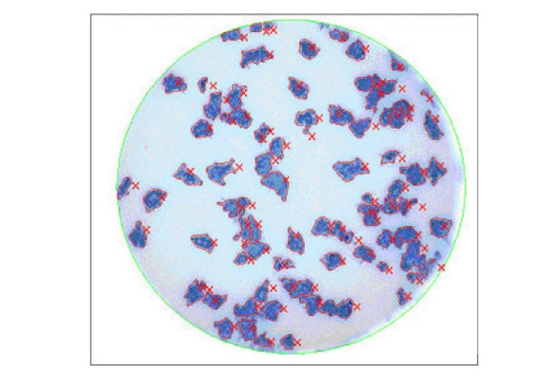 Development of an improved microneutralization assay for respiratory syncytial virus by