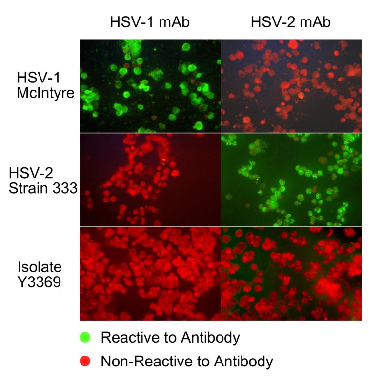 Characterization of herpes simplex virus clinical isolate Y3369 as a