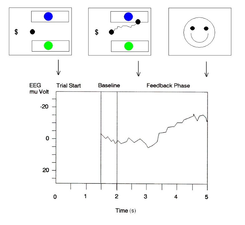 Conditional Associative Learning Examined In A Paralyzed Patient With Amyotrophic Lateral Sclerosis Using Brain Computer Interface Technology Springerlink Conditional Associative Learning Examined In A Paralyzed Patient With Amyotrophic Lateral Sclerosis Using Brain Computer Interface Technology Springerlink
