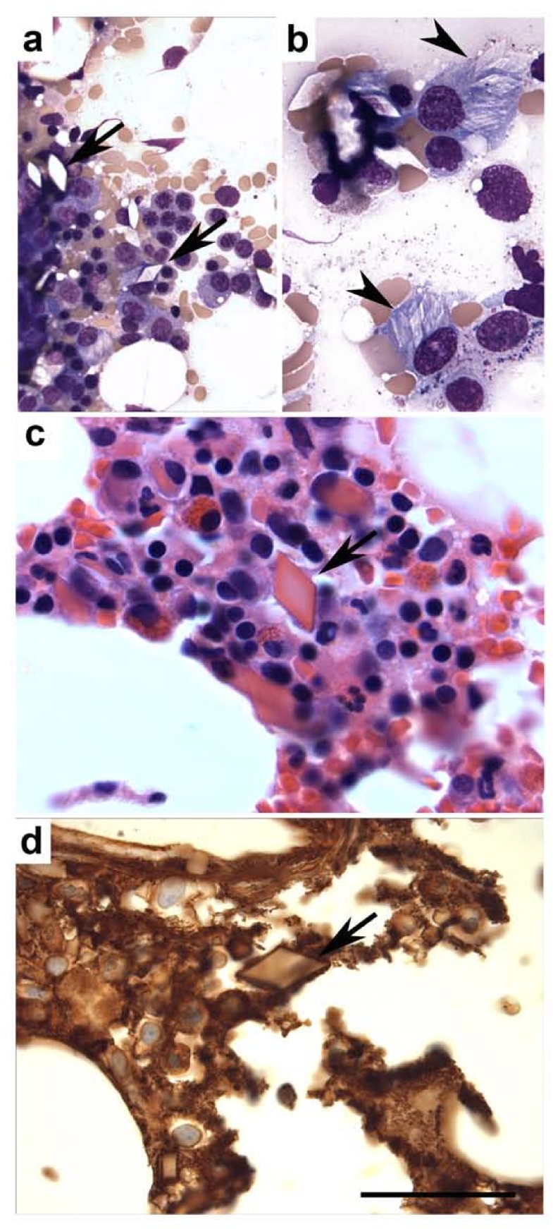 Intracellular and extracellular rhomboid shaped crystalline inclusions