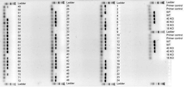 detecting erecta gene using pcr and qtl analysis Qtl (quantitative trait locus) analysis links genetic markers with dna base variations, such as single-nucleotide polymorphisms (snps) and microsatellite or simple sequence repeats (ssrs) to the qtls of interest for breeding purposes. detecting erecta gene using pcr and qtl analysis Qtl (quantitative trait locus) analysis links genetic markers with dna base variations, such as single-nucleotide polymorphisms (snps) and microsatellite or simple sequence repeats (ssrs) to the qtls of interest for breeding purposes.
