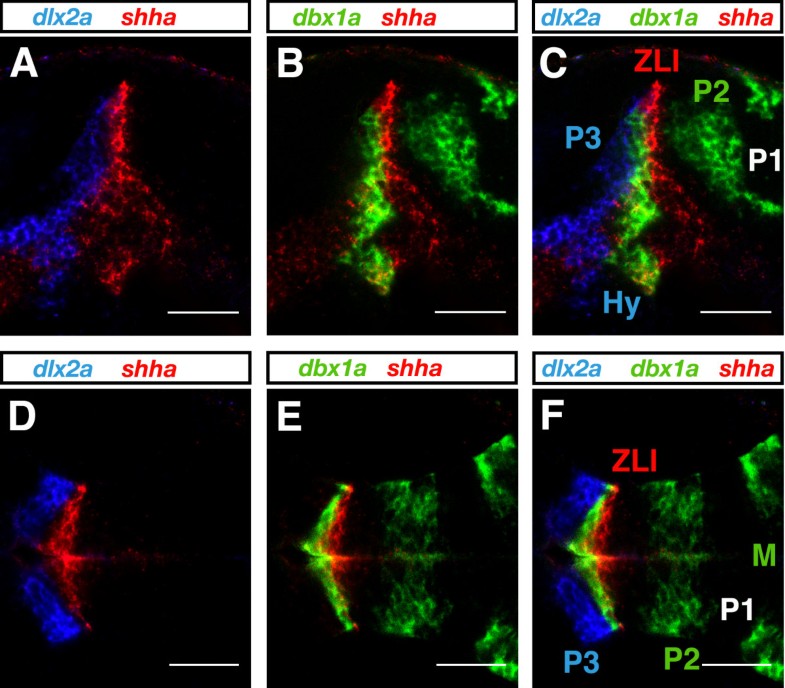 Multicolor fluorescent in situ hybridization to define abutting and