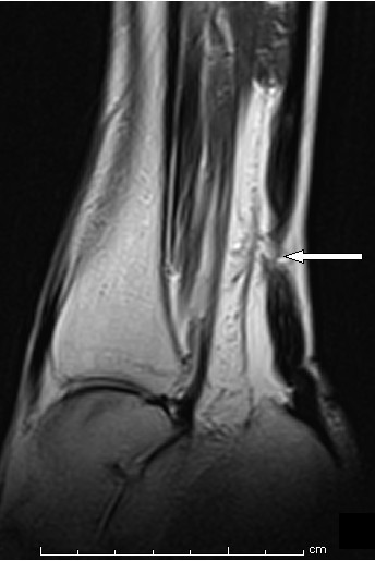 Can mri penetrate through cast, mindy cohn nude
