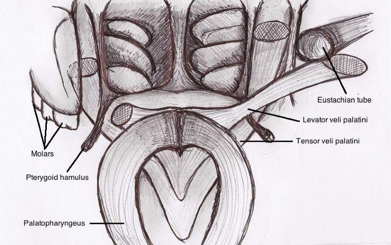 Essential palatal myoclonus following dental surgery: a case report ...