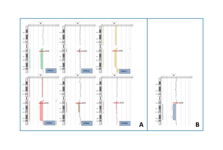 Different loss of material in recurrent chromosome 20 interstitial
