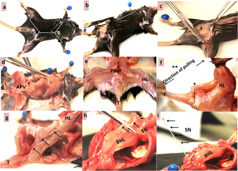 Harvesting the maximum length of sciatic nerve from adult ... cut leg diagram 