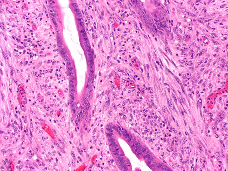 tan irregular soft tissue fragments meaning tan irregular soft tissue fragments meaning