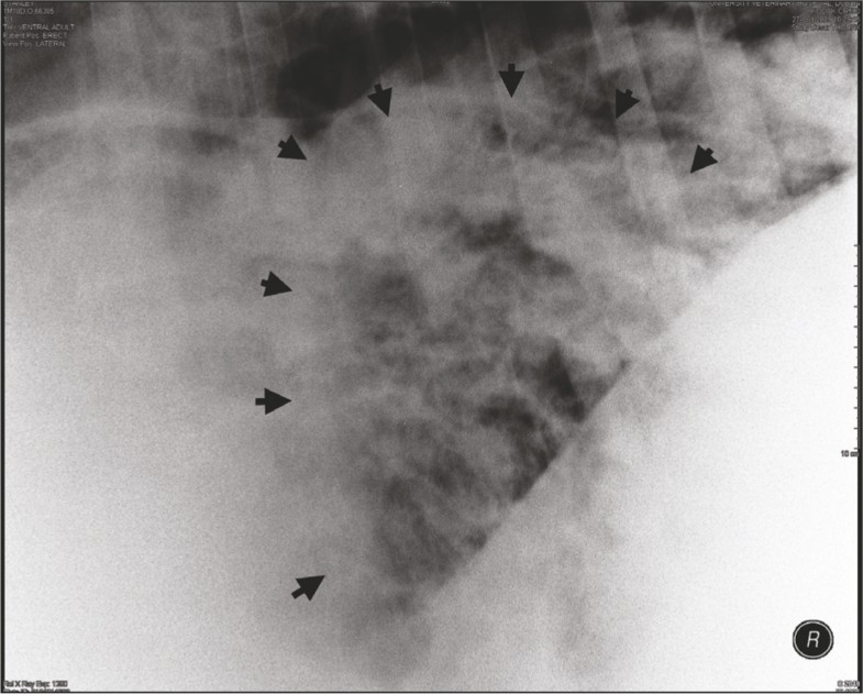 latrogenic lipoid pneumonia in an adult horse Irish Veterinary Journal Full Text