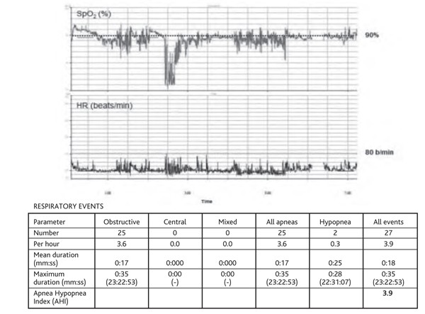 jak2 test blood negative erythrocytosis how mutation V617F JAK2 to (or
