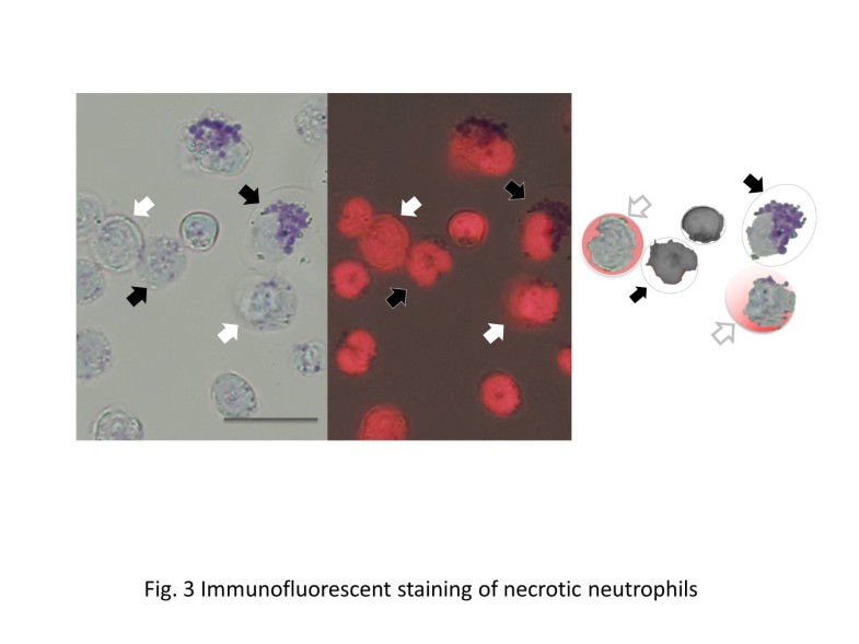 Neutrophil cell death in response to infection and its relation to