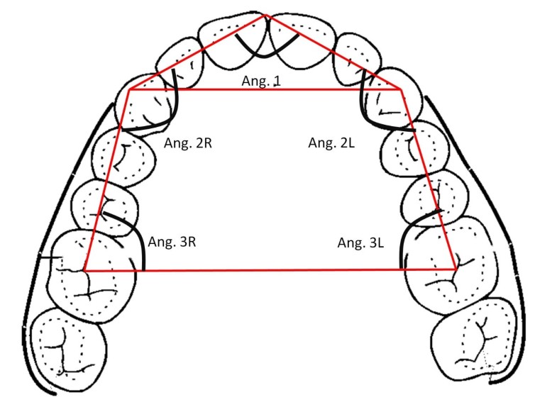Relationship between vertical facial patterns and dental arch form in