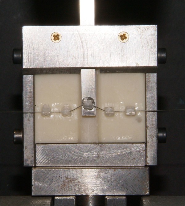 Frictional resistance in monocrystalline ceramic brackets with