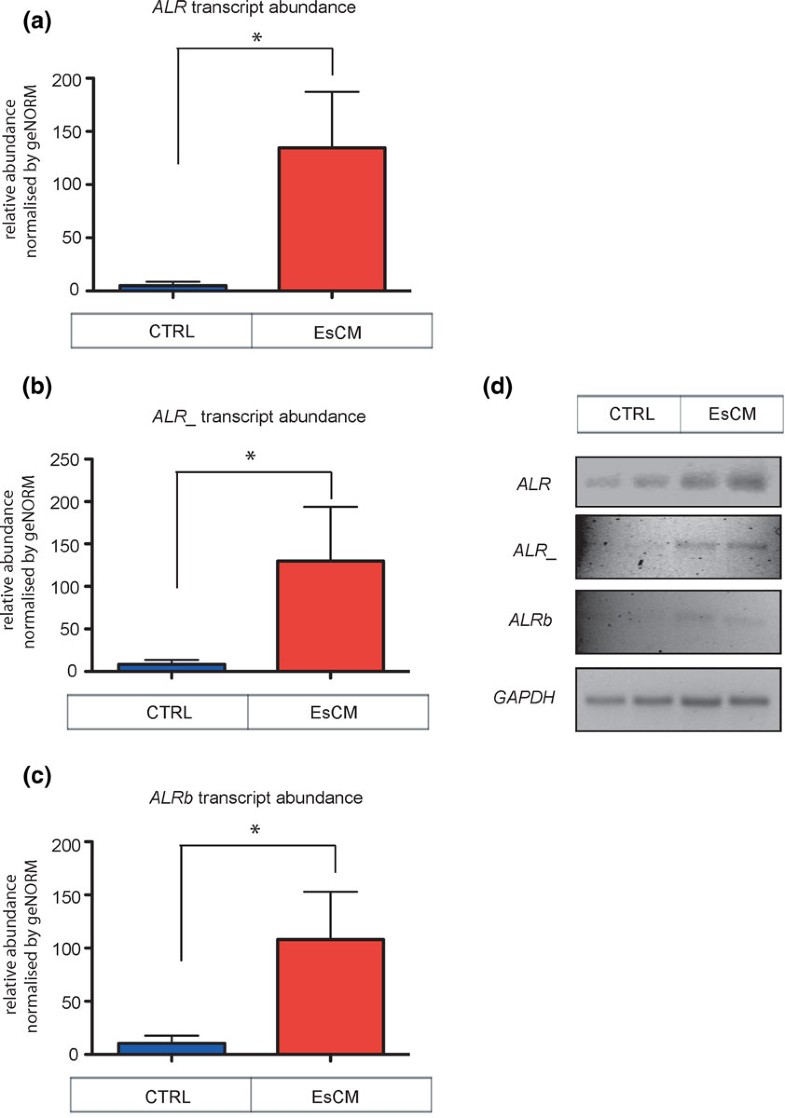 The Landscape Of Dna Repeat Elements In Human Heart Failure