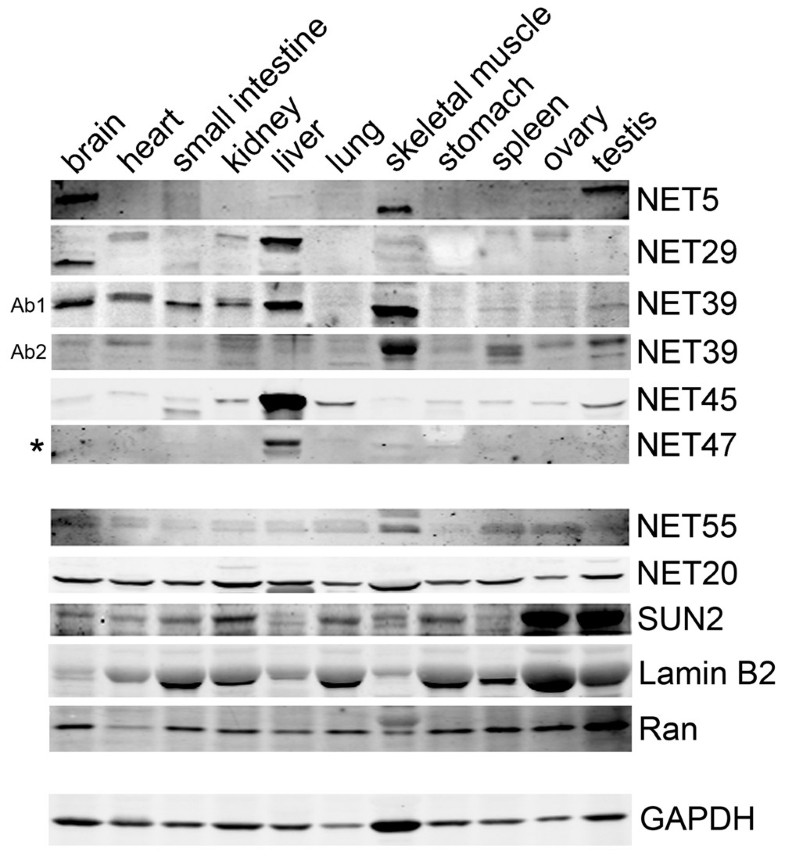 Specific nuclear envelope transmembrane proteins can promote the