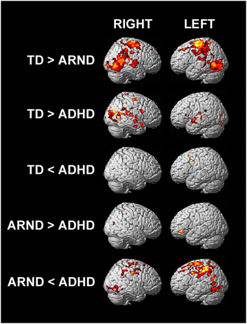 t=1/9(x-y+z) Visual for an conjunctions: fMRI study search feature t=1/9(x-y+z) Visual for an conjunctions: fMRI study search feature