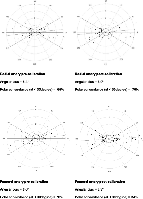 pressure zone exclusion test pressure value output waveform arterial of The cardiac