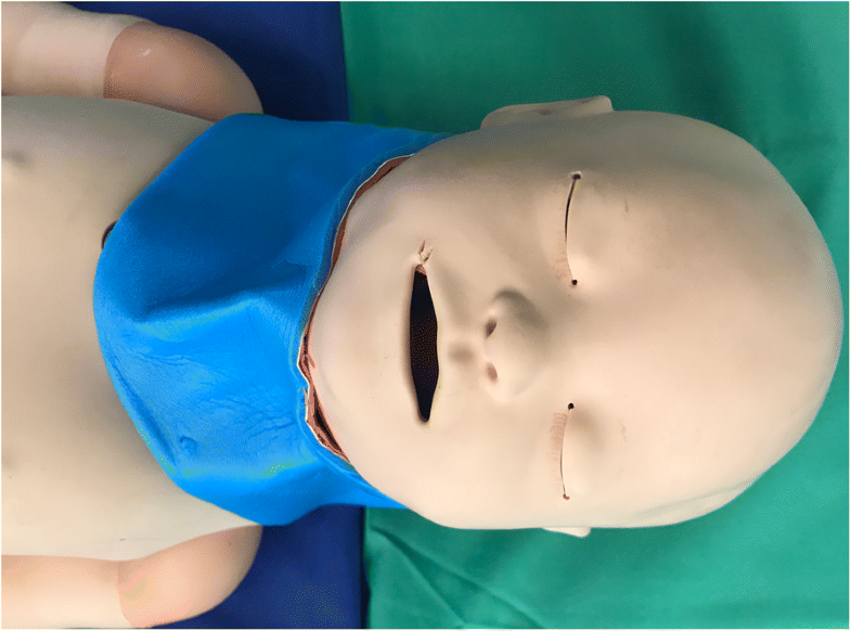 A comparison of two hyperangulated video laryngoscope blades to direct