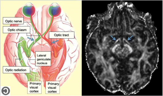 thebrain mcgill ca thebrain mcgill ca