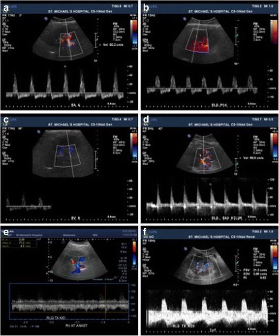 The role of thrombectomy and diffusionweighted imaging with MRI in