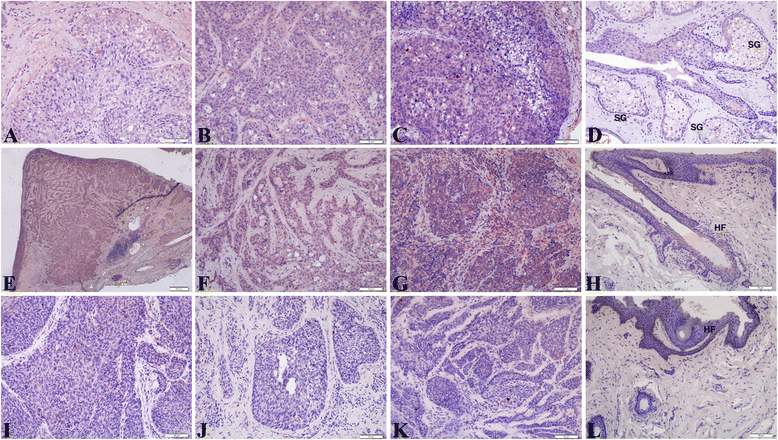 l.control.scale proteins binding retinoic acid Expression and of retinoic l.control.scale proteins binding retinoic acid Expression and of retinoic