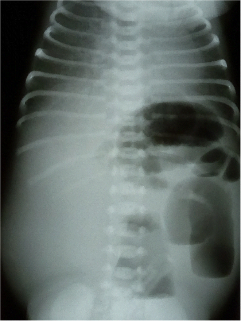 investigation confirmed the clinical phenotype of congenital