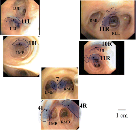 Expert opinion of mediastinal lymph node positions from an
