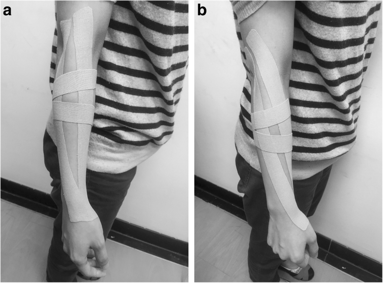 Kinesio taping reduces elbow pain during resisted wrist extension in