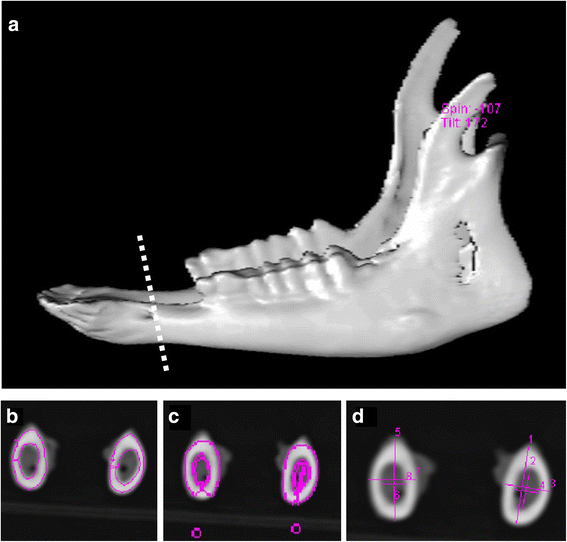 morphological densitometric and mechanical