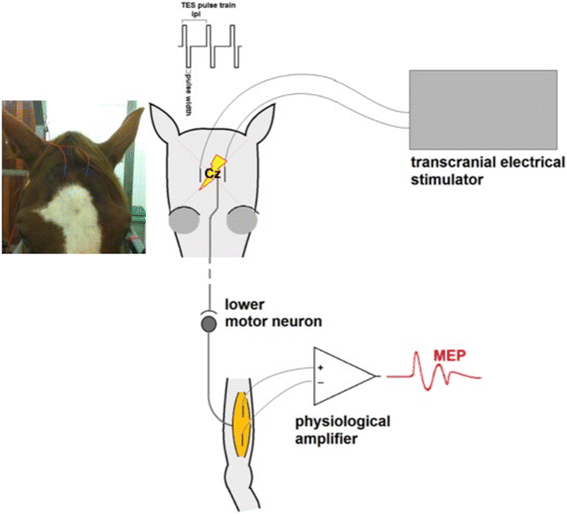 Multipulse transcranial electrical stimulation (TES) normative data