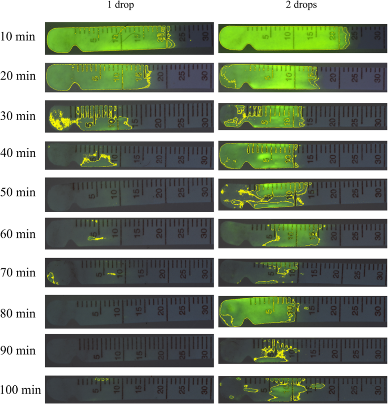Photographybased method for assessing fluorescein clearance test in