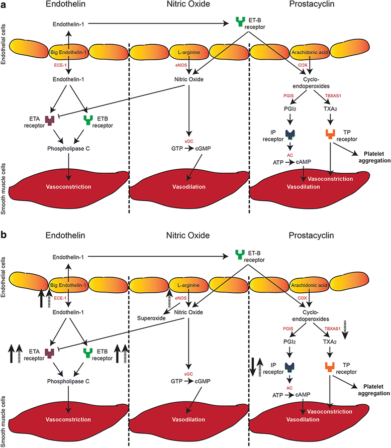 Changes in vasoactive pathways in congenital diaphragmatic hernia