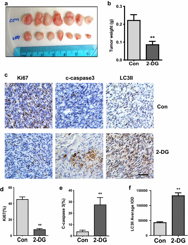 Inhibition of glycolytic enzyme hexokinase II (HK2) suppresses lung