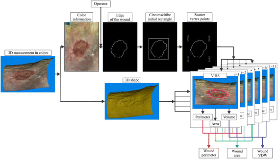 Wound Perimeter Area And Volume Measurement Based On