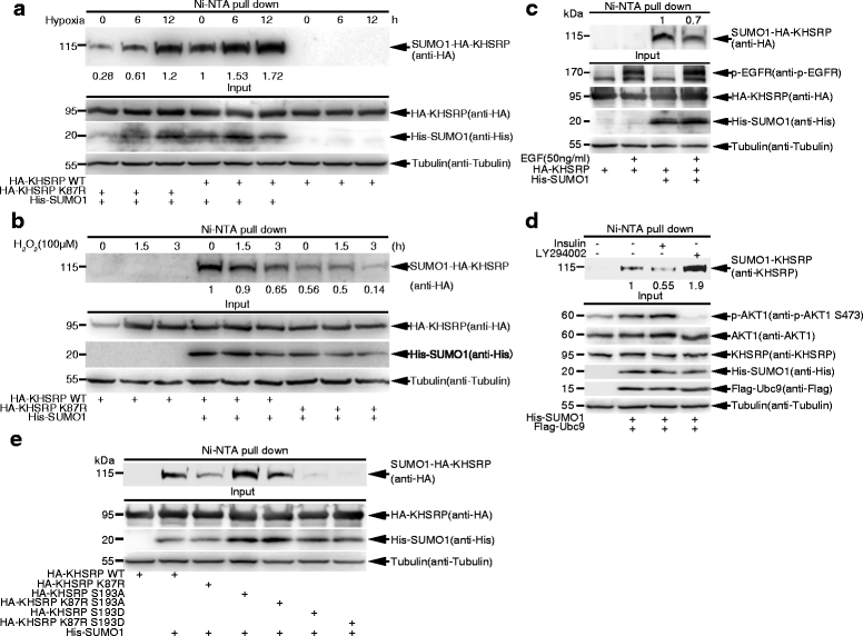 SUMO1 modification of KHSRP regulates tumorigenesis by 