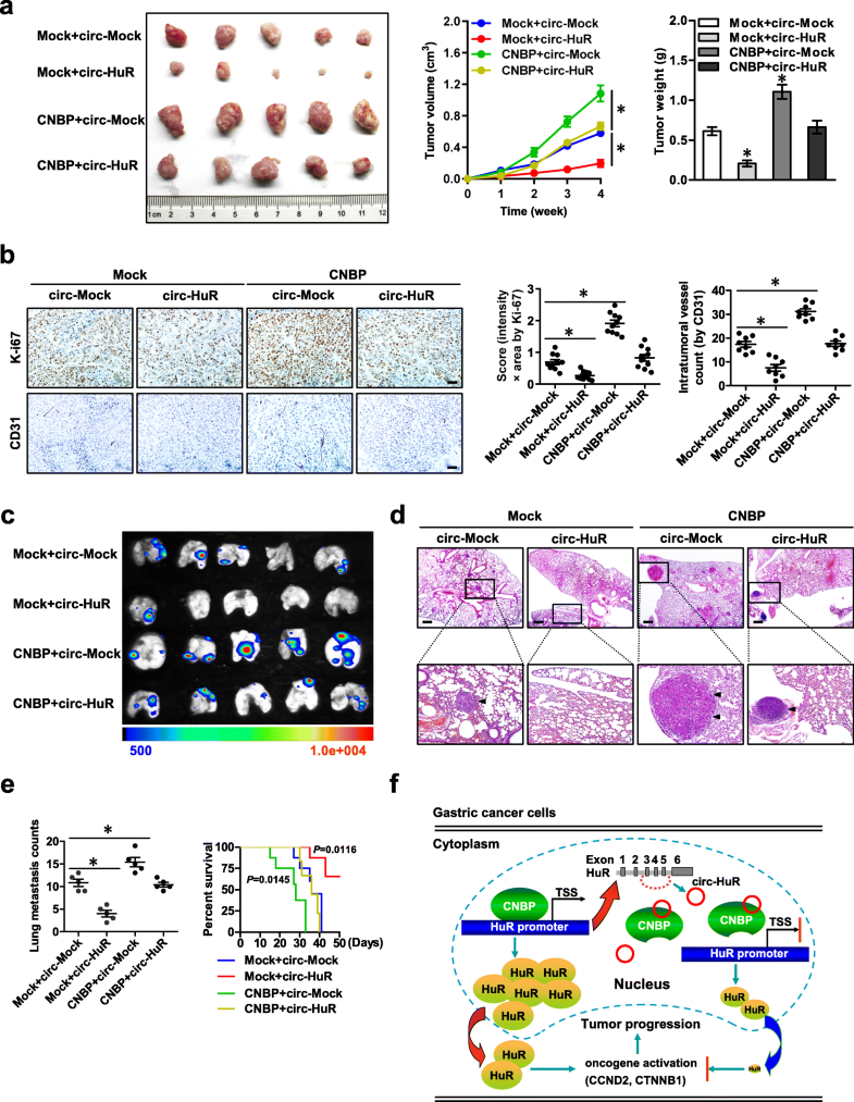 Circ-HuR suppresses HuR expression and gastric cancer 