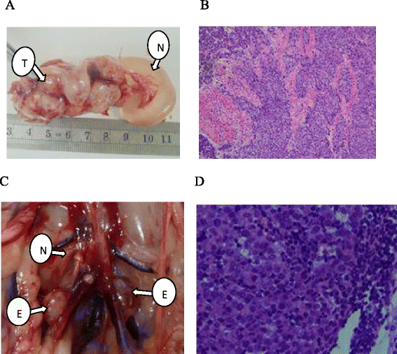 Establishment of the retroperitoneal lymph node metastasis model of