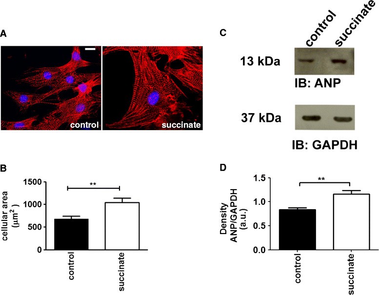 Succinate causes pathological cardiomyocyte hypertrophy through GPR91