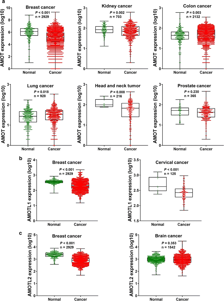 Nature Review Signaling Pathway In Brain Tumors Nature Review Signaling Pathway In Brain Tumors