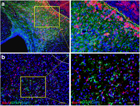 Infiltration And Persistence Of Lymphocytes During Late - 