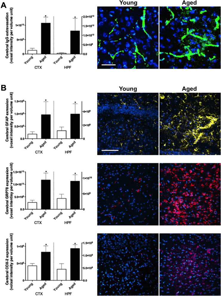 blood brain barrier definition blood brain barrier definition