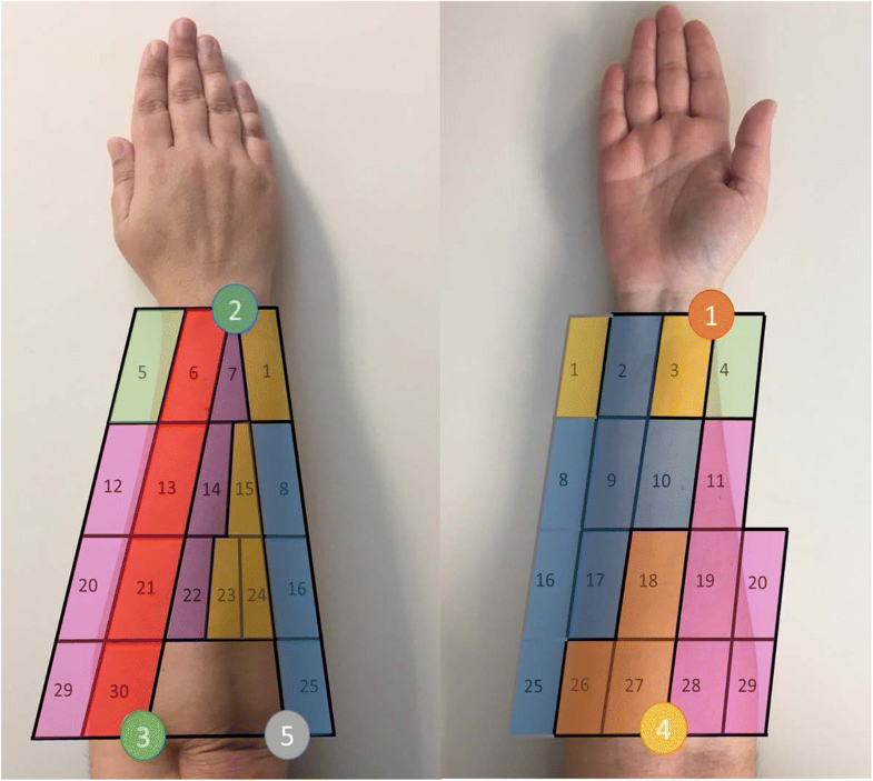 Identification of forearm skin zones with similar muscle activation ...